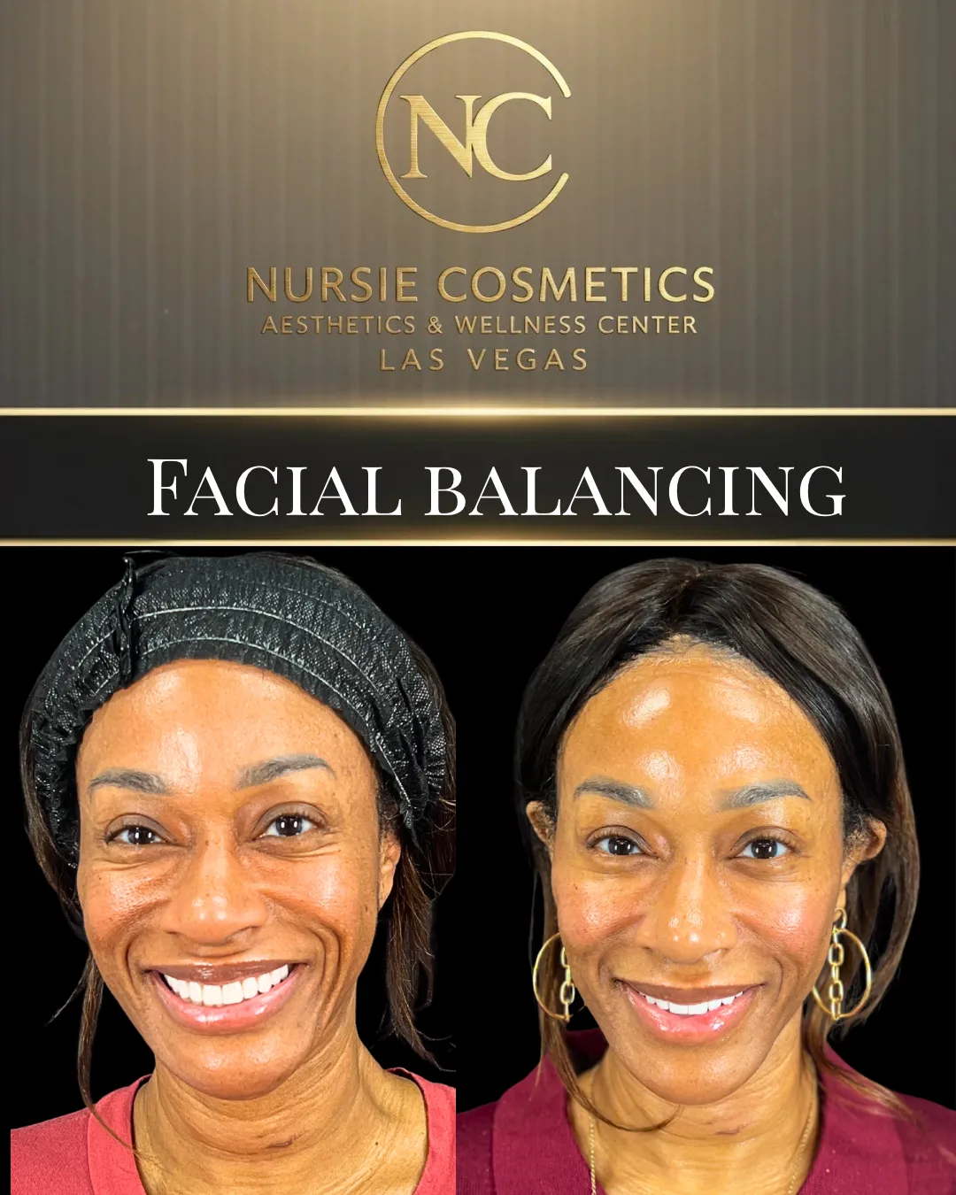 Before and after facial balancing at Nursie Cosmetics