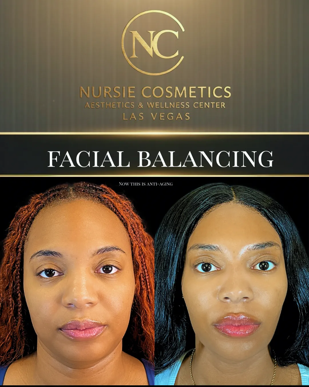 Before and after facial balancing
