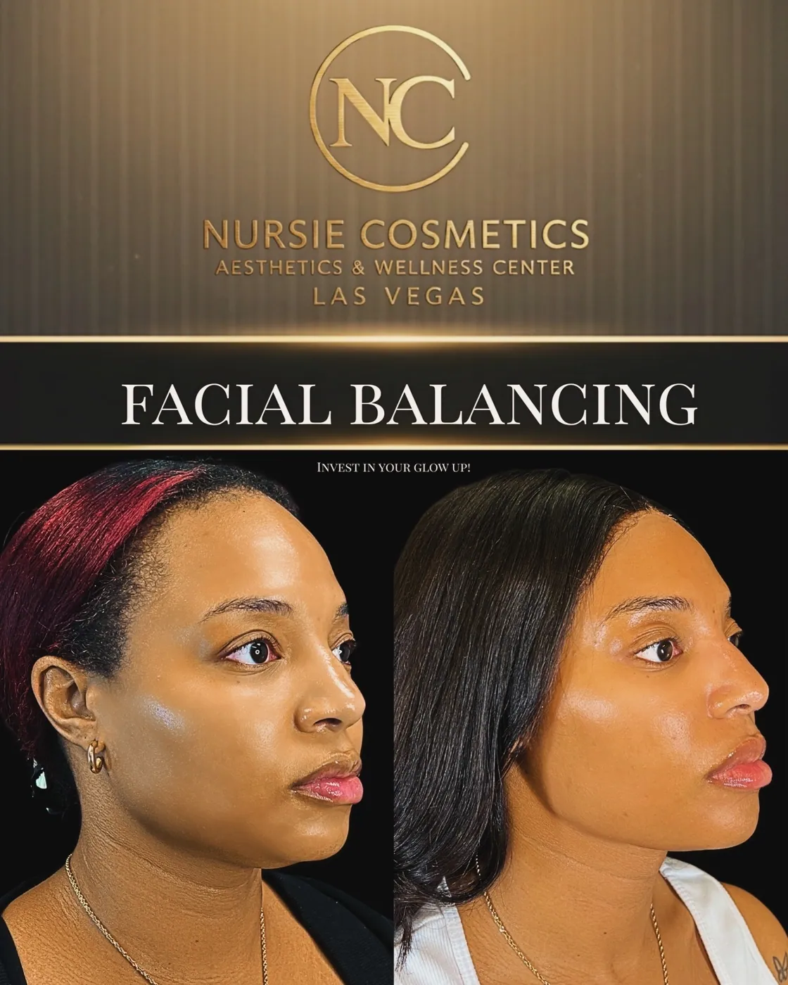 Before and after facial balancing