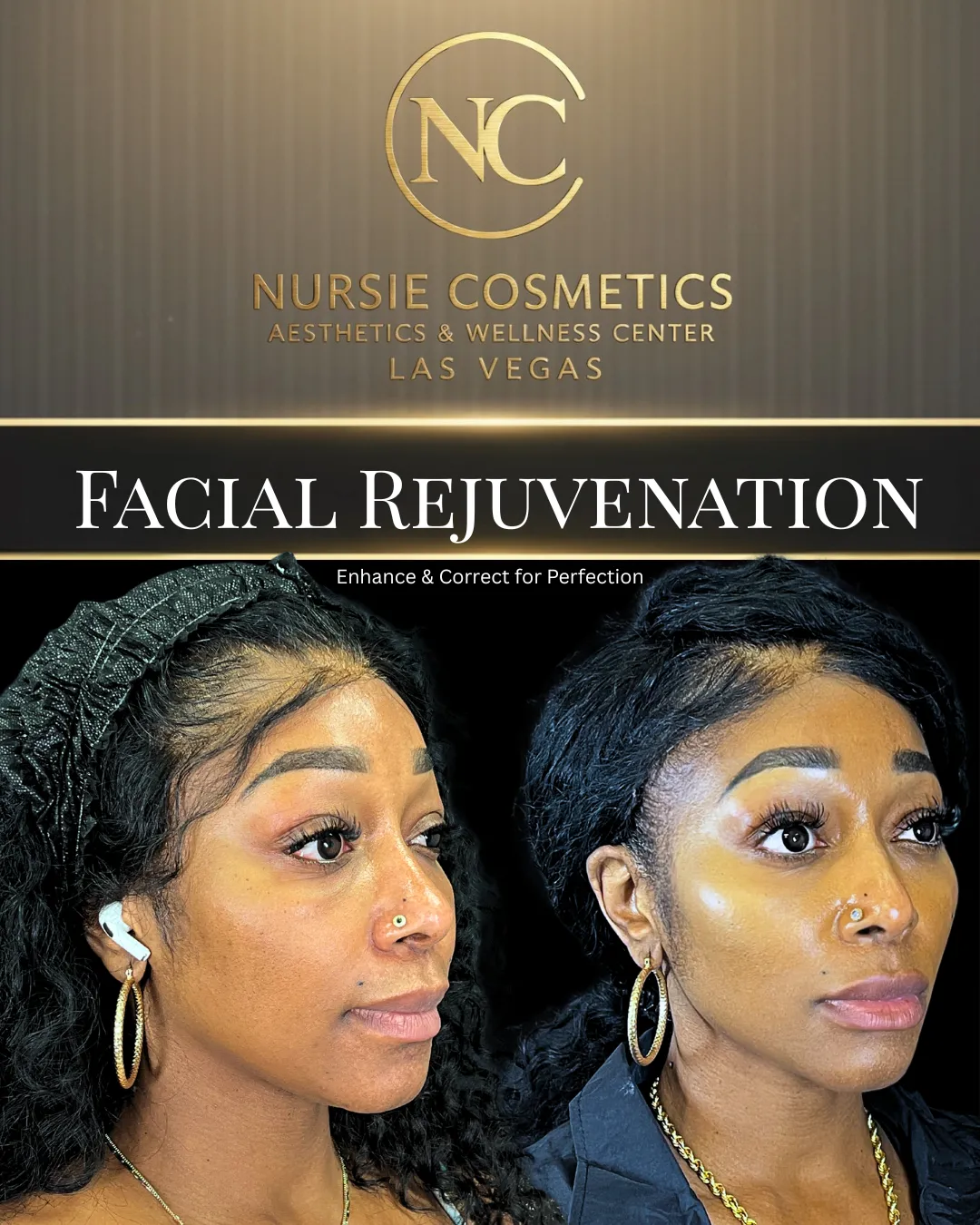 Before and after facial rejuvenation