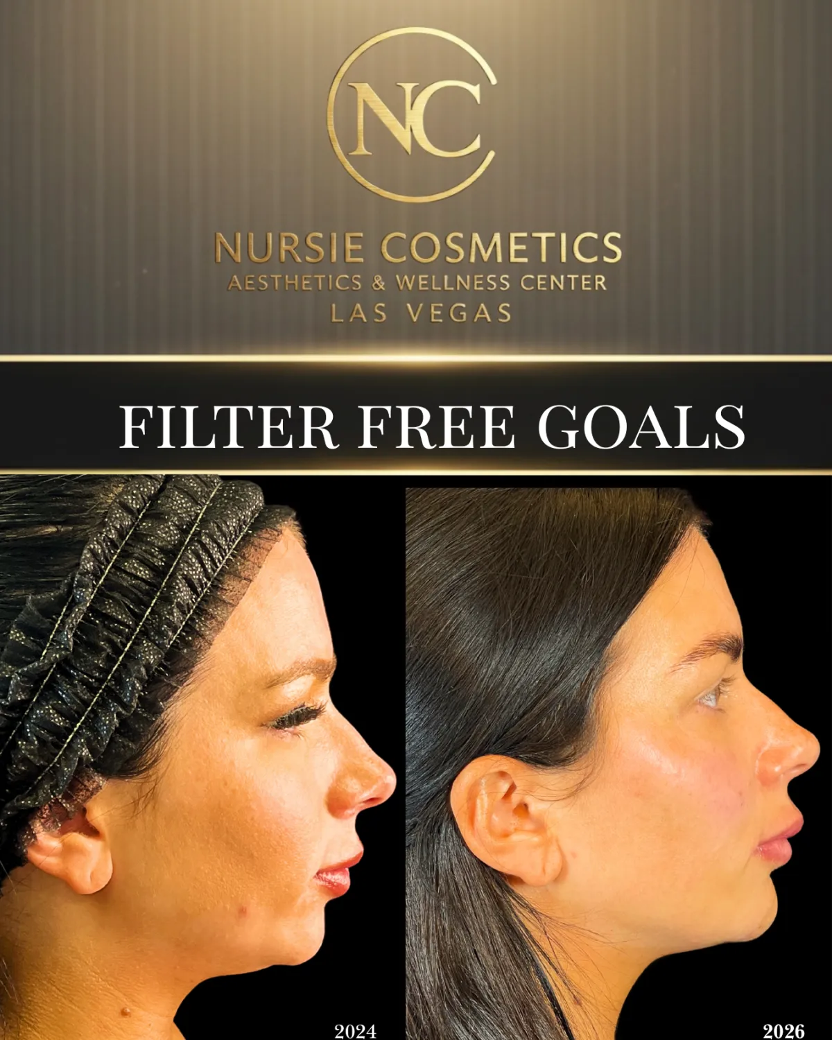 Before and after filter free goals result