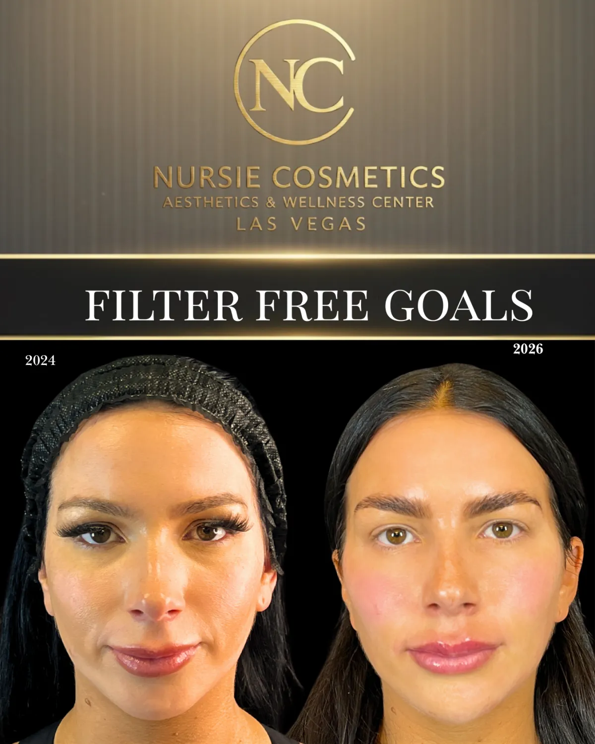 Before and after filter free goals result