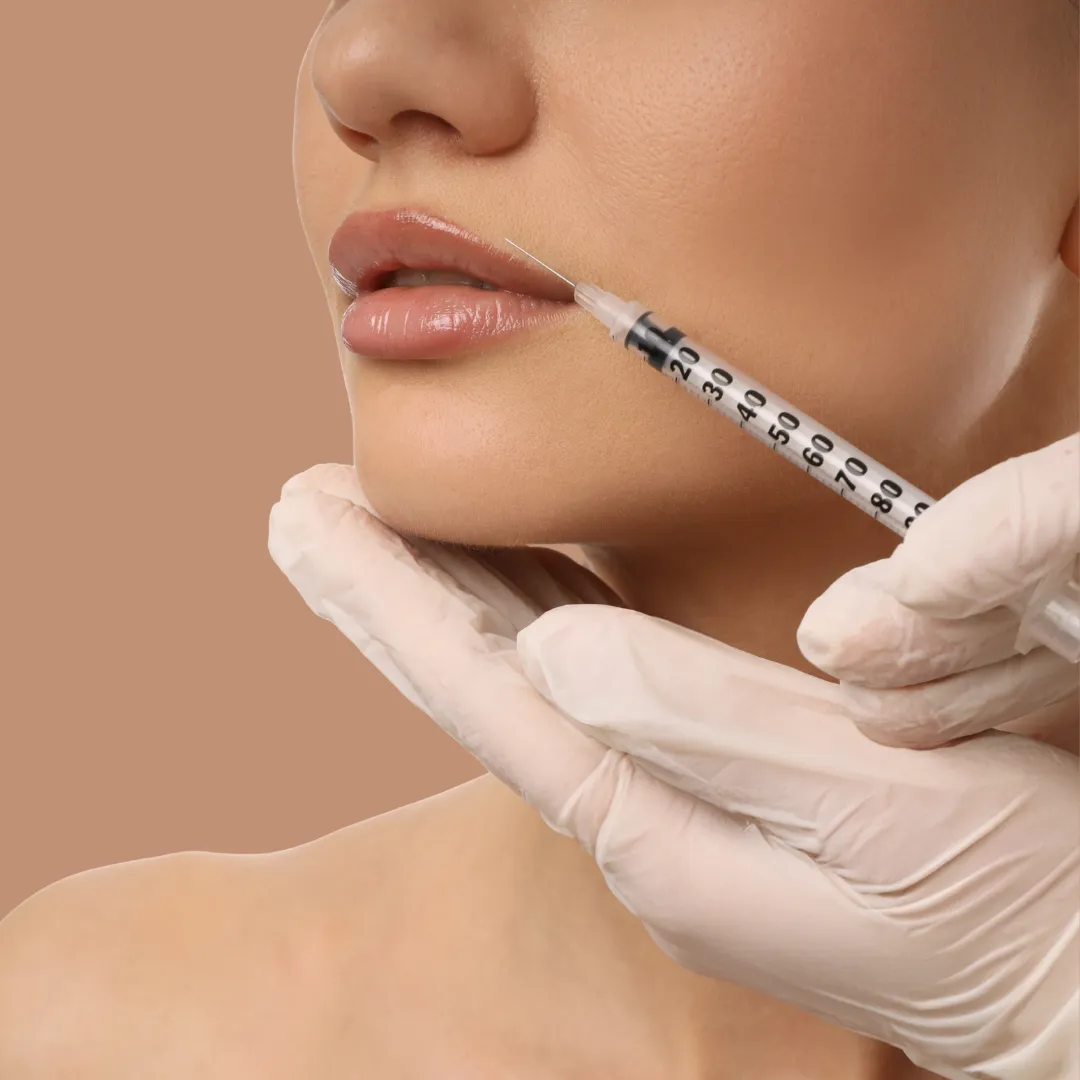 Dermal filler treatment at Nursie Cosmetics